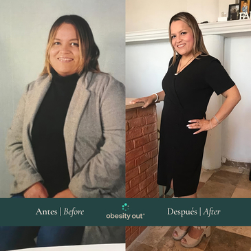 Slider image (9) Obesity Out Bariatric Surgery Center